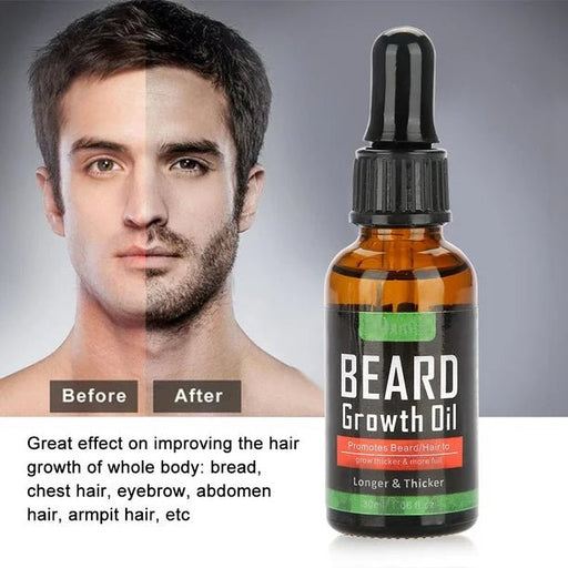 Bigote Enhancer, Aceite para el crecimiento de la barba - Quierox - Tienda Online